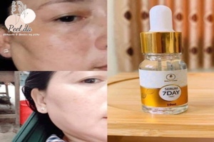 Huyết thanh truyền trắng 7 Day Olic có tốt không