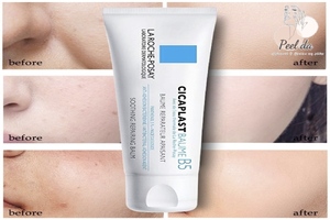 Kem dưỡng La Roche Posay Cicaplast Baume B5 là sản phẩm chuyên dùng để phục hồi