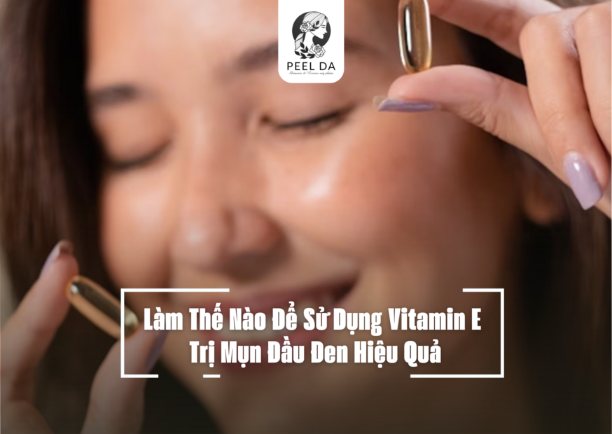 Làm Thế Nào Để Sử Dụng Vitamin E Trị Mụn Đầu Đen Hiệu Quả
