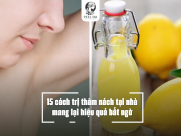 15 cách trị thâm nách tại nhà mang lại hiệu quả bất ngờ