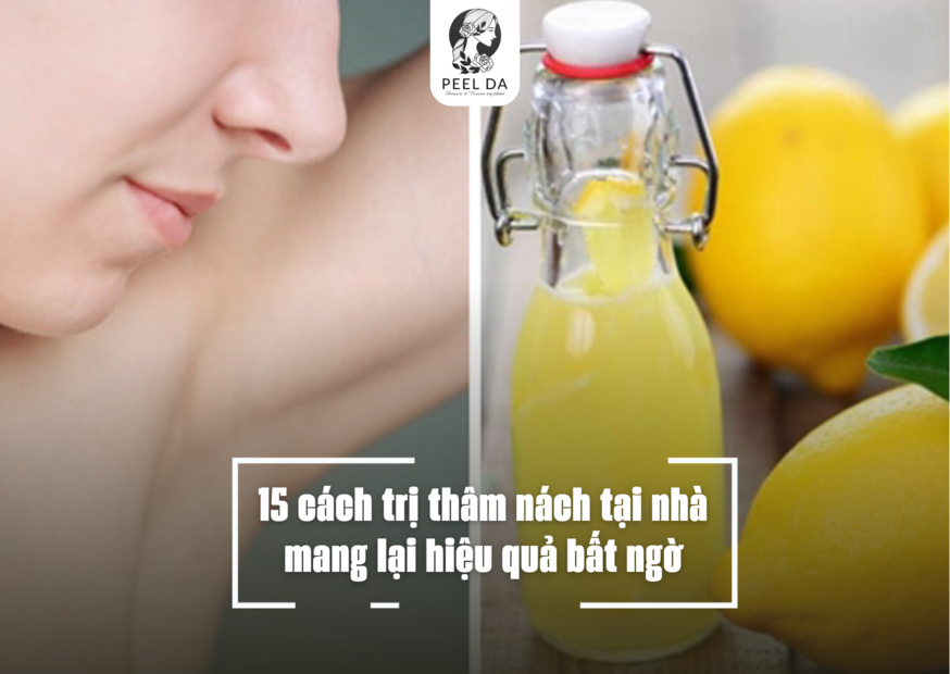 15 cách trị thâm nách tại nhà mang lại hiệu quả bất ngờ